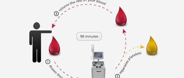 How Does Platelet Donation Work? A Must Read Guide
