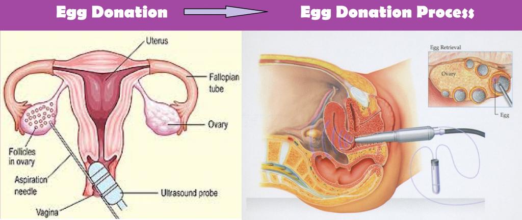 Egg Donation Process: Medical Procedure and its Success Rates in India | Seed Art Bank