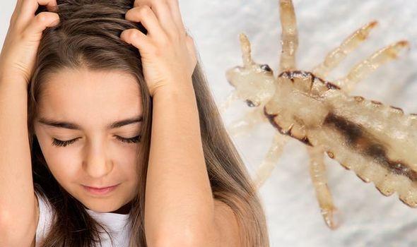 Head lice treatment: How to get rid of your child's nits - best shampoo | Express.co.uk