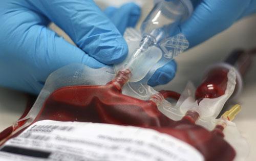 AUTOLOGOUS BLOOD TRANSFUSION - Healthcare and Disease Prevention Tips - Blog - Venkateshwar Hospital
