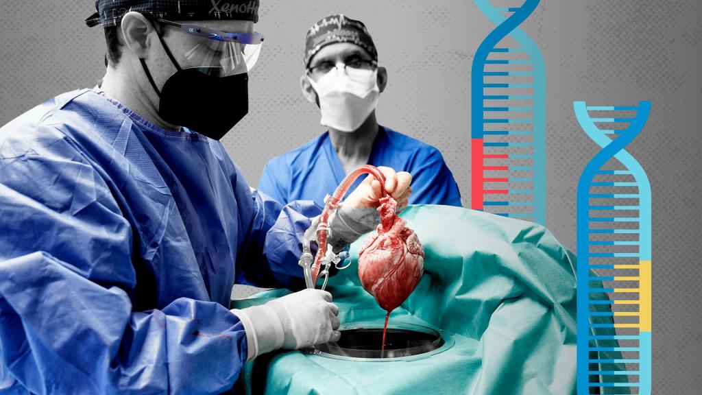 What Happens During An Organ Transplant